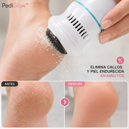 PediGlow™-  Removedor quita callos recargable